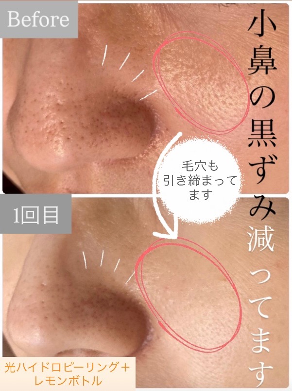 1回目の効果で...😳