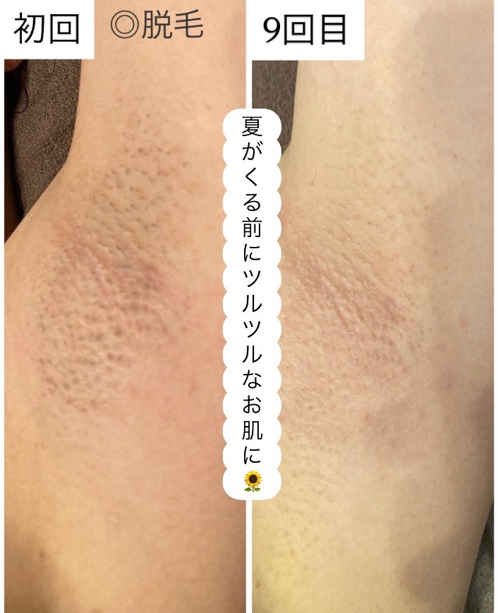 夏が来る前に🌻