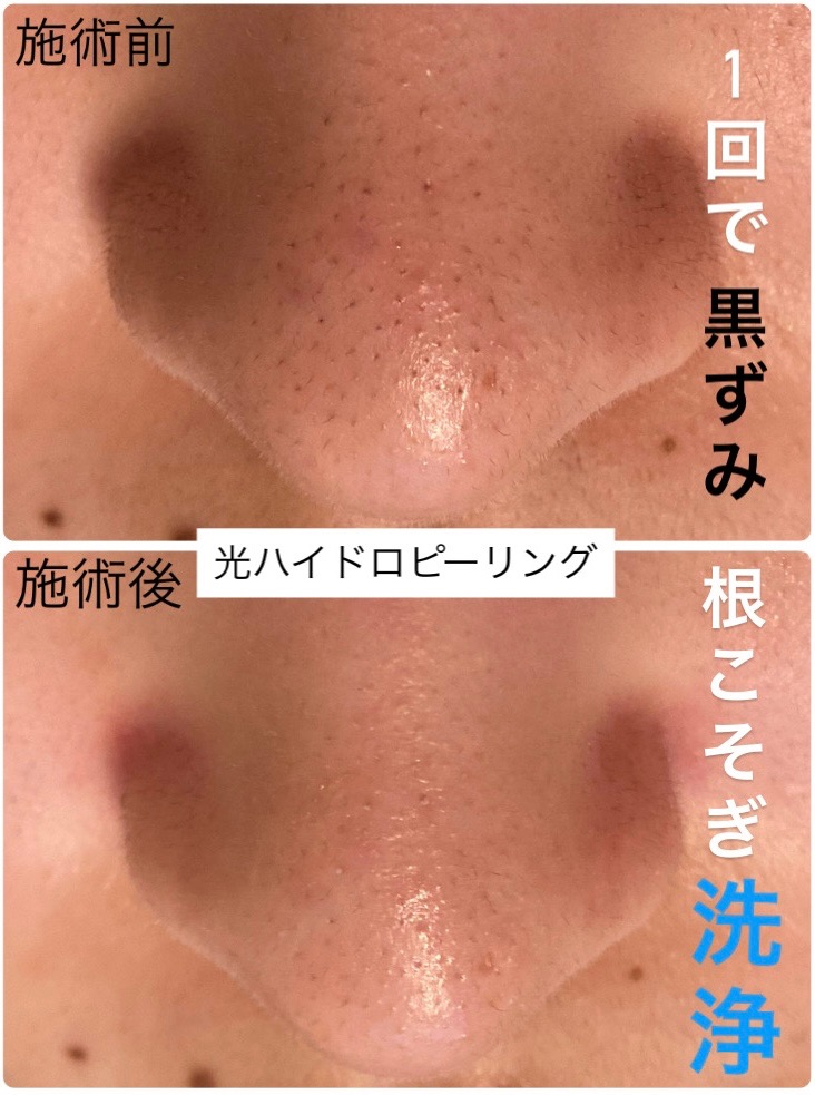 1回で根こそぎ洗浄！