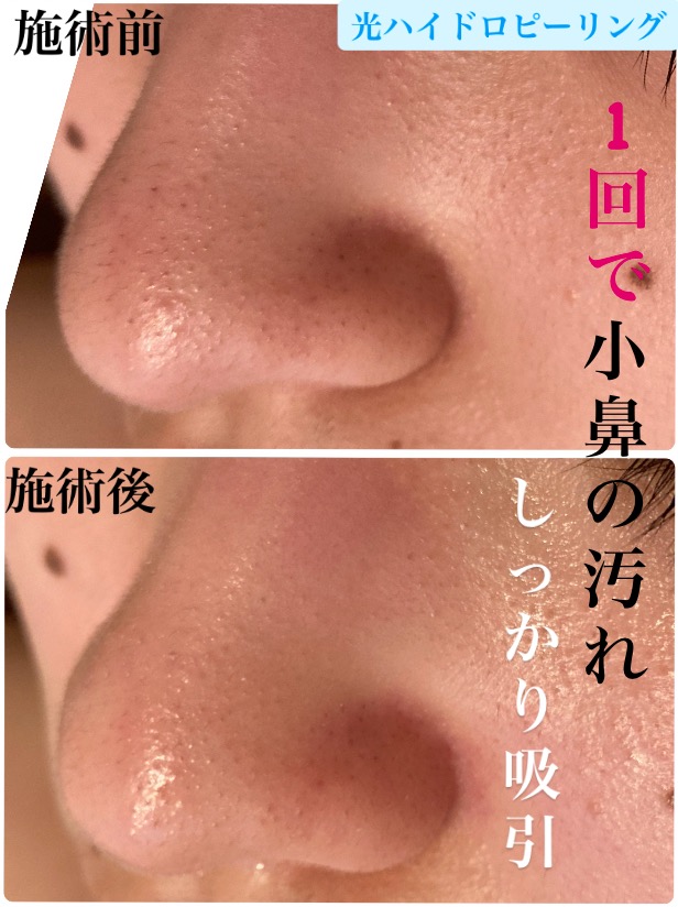 1回で効果実感(^^)