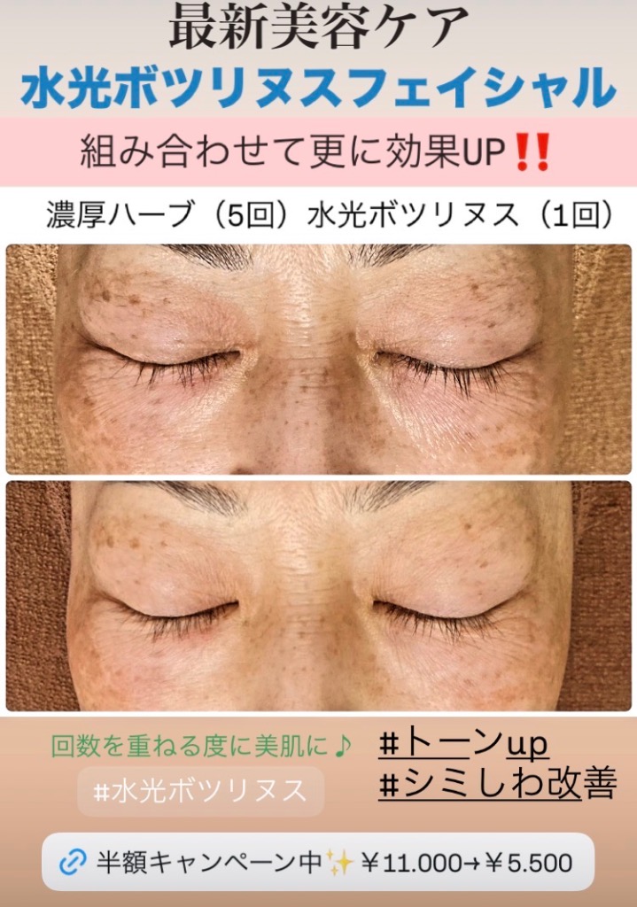 シミしわハリの改善に◎