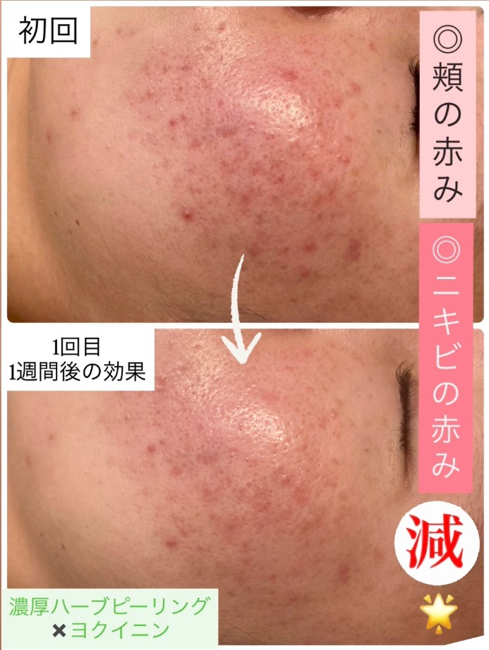 1週間後の効果...👀✨