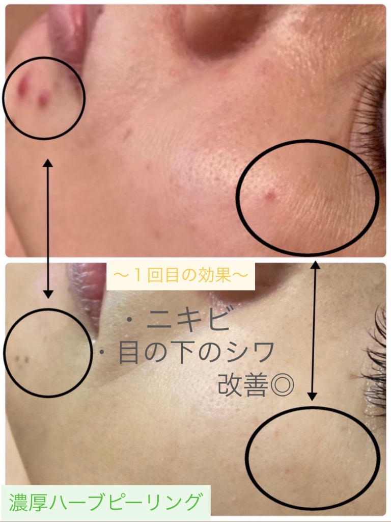 お肌のお悩み改善◎
