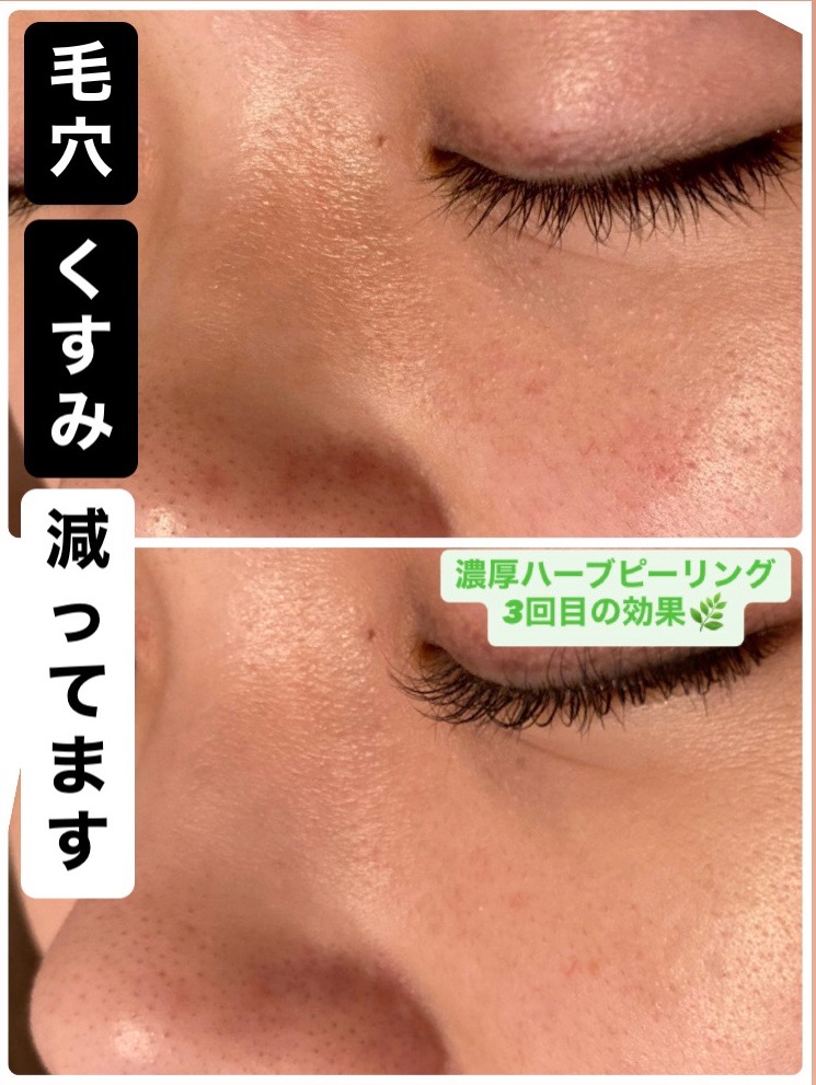 くすみ激減！！