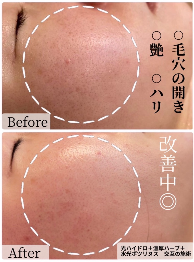 お肌にハリ、艶増してます🫧