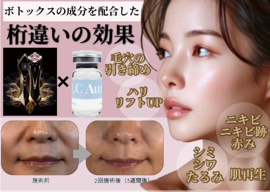 🫧水光ボツリヌスフェイシャル🫧