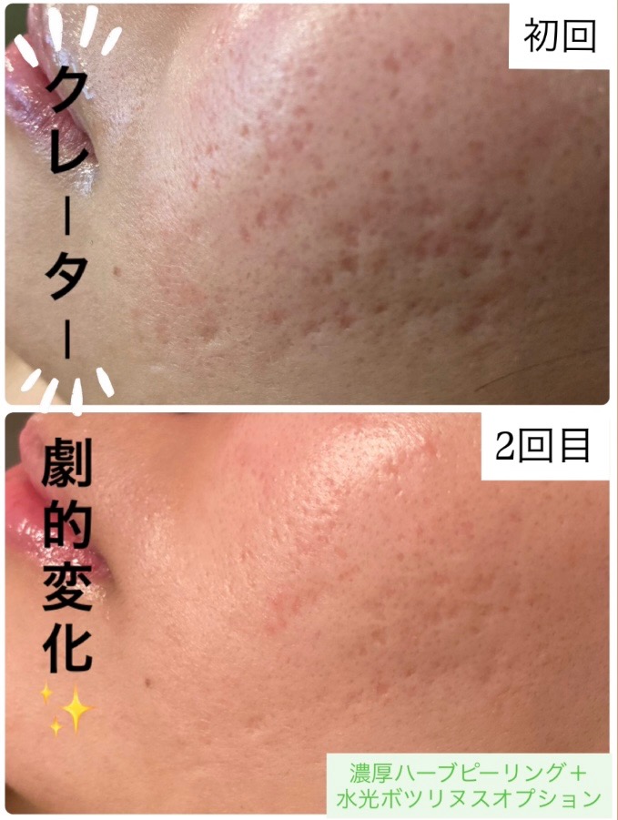 お肌劇的変化😳✨✨
