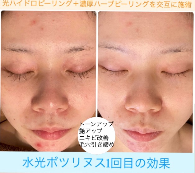 トーンアップして艶肌に(^^)