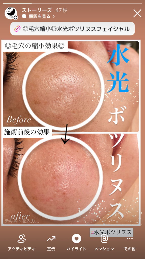 毛穴の縮小効果がしつかり出てます◎