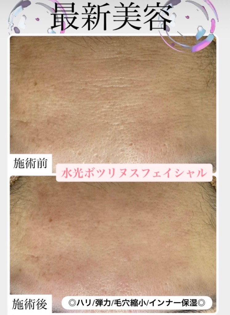 15分後にこの変化✨