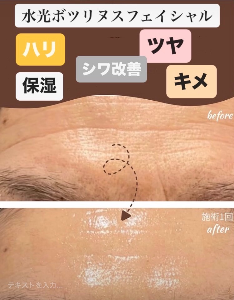 施術1回目の効果