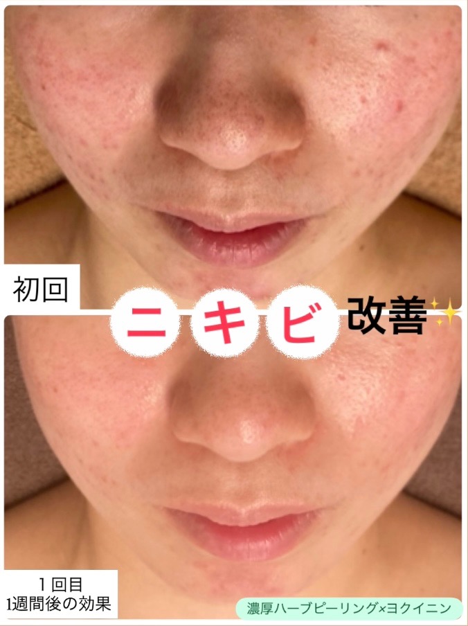 １回の効果で...