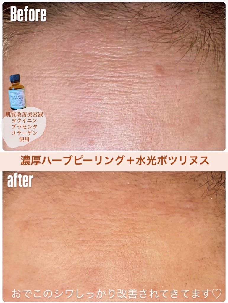 シワ改善✨