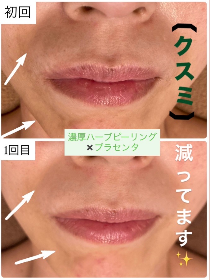 クスミ減ってます！！