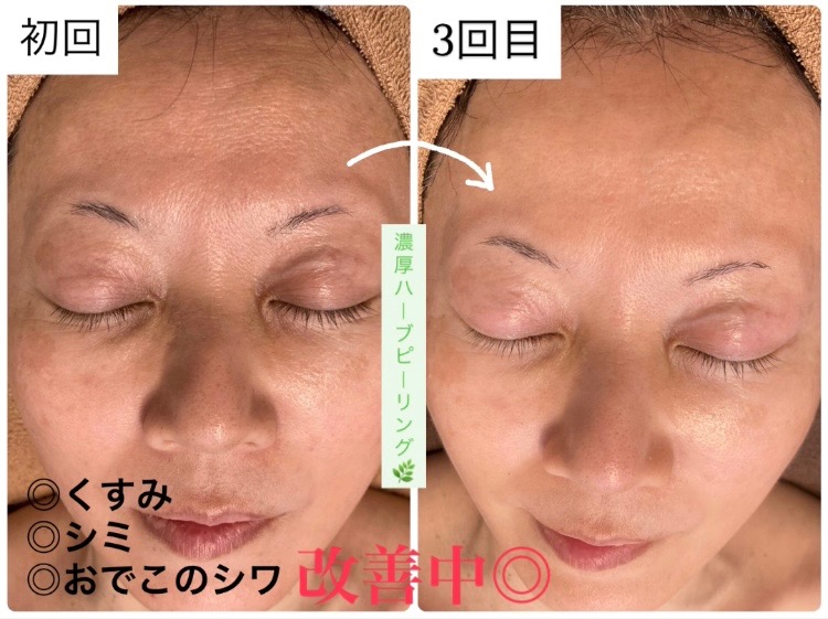 シミ/シワ/くすみに◎