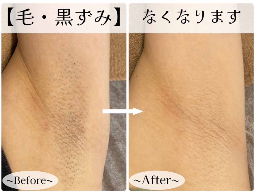 黒ずみもなくなります✨