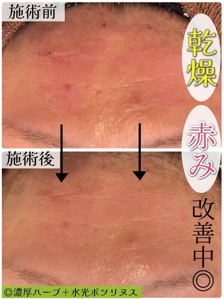 １回目の効果で...😳✨