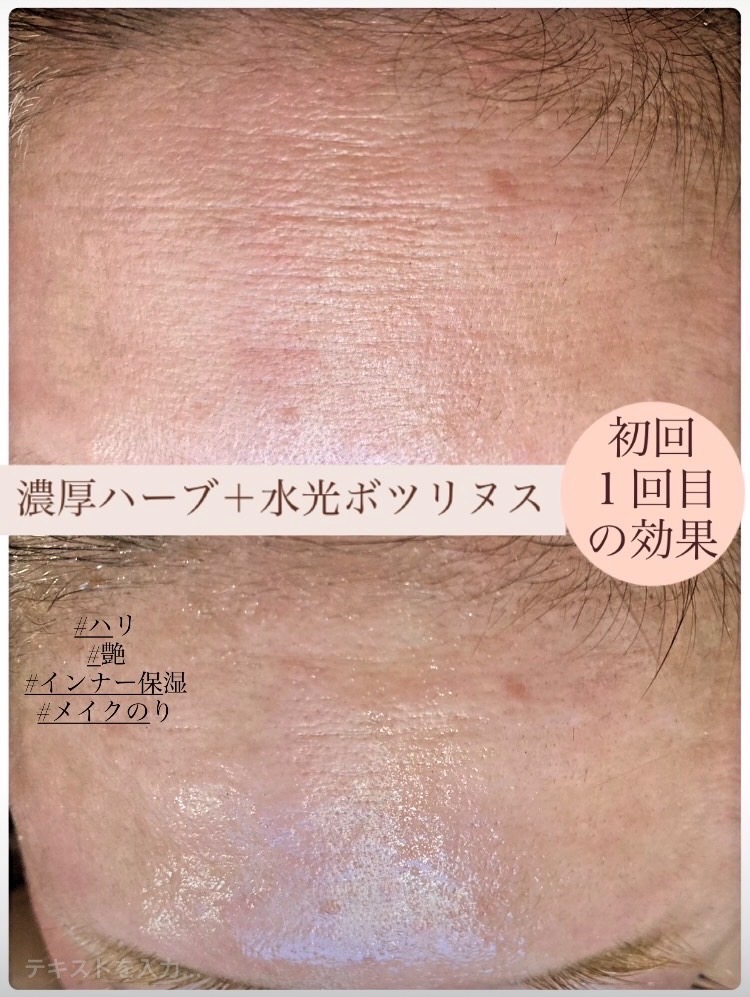 1回がシワがピーン✨