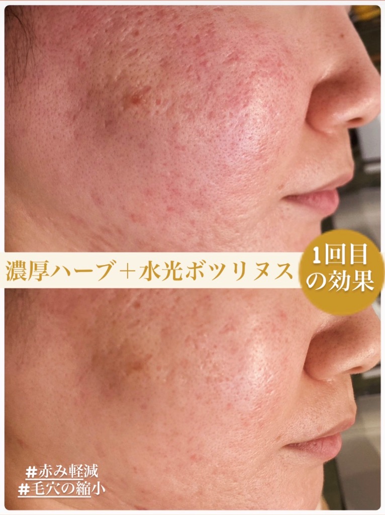 1回目の効果･:*+.\(( °ω° ))/.:+