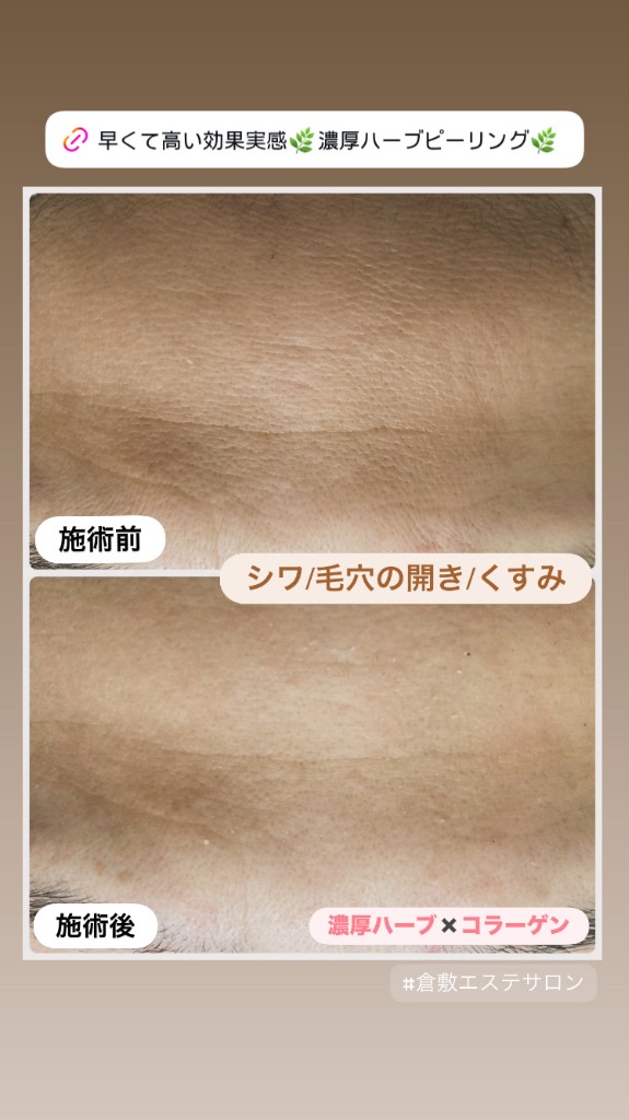 一回の効果はもちろん持続力も◎