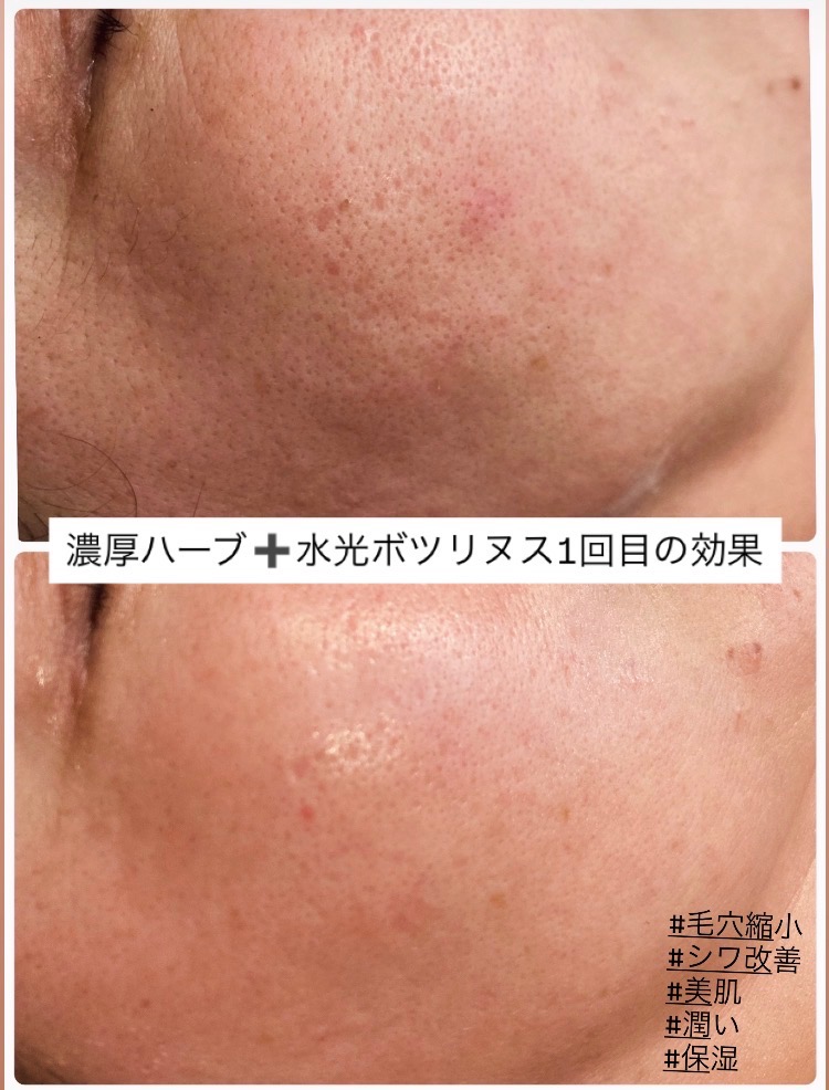 組み合わせで更に効果UP！