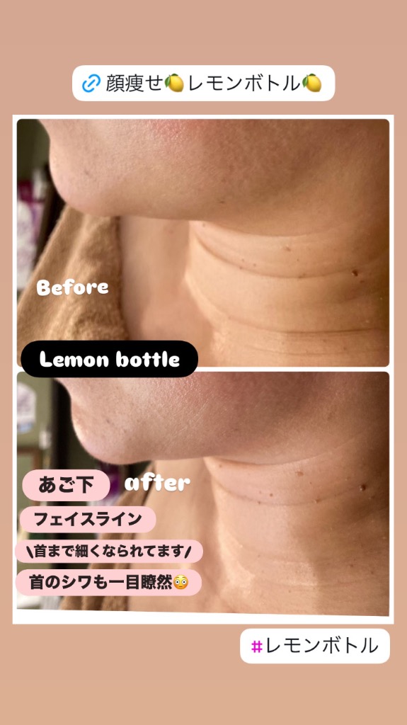 目の下〜首までしっかり施術◎